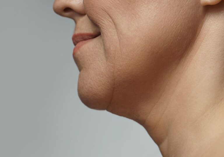 Peri-Menopause Face: Why Your Jawline & Neck Change So Fast After 50 — And What Actually Works